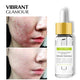 Tea tree acne cream