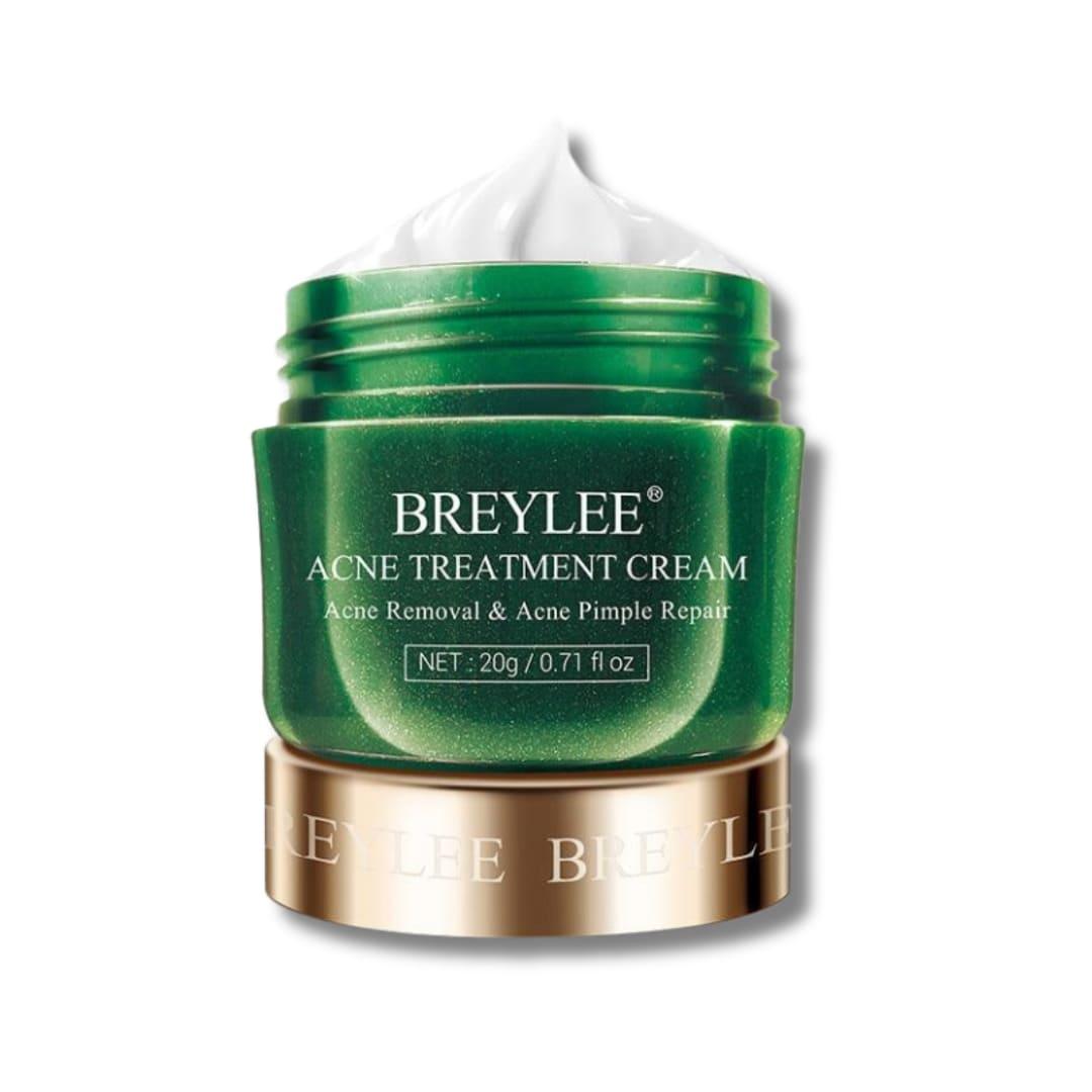 Acne Treatment Moisturizing Cream BREYLEE - LendaSphere